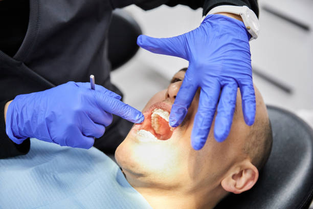 Best Emergency Broken Tooth Repair in Lebanon, NH